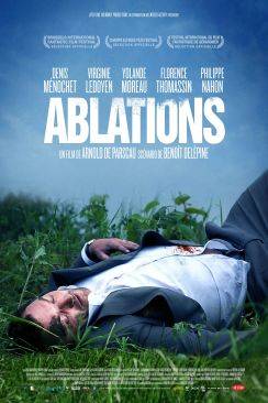 Ablations wiflix